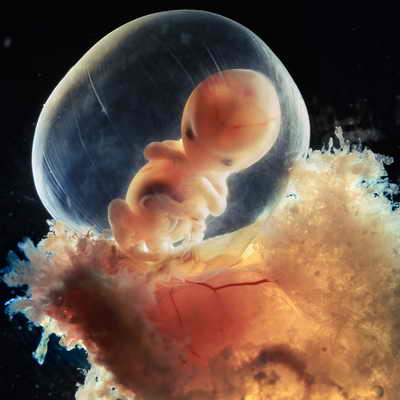 Фото человеческого эмбриона