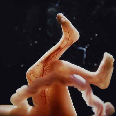 Фото человеческого эмбриона