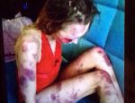 Анастасия Овсянникова жертва насилия избиение