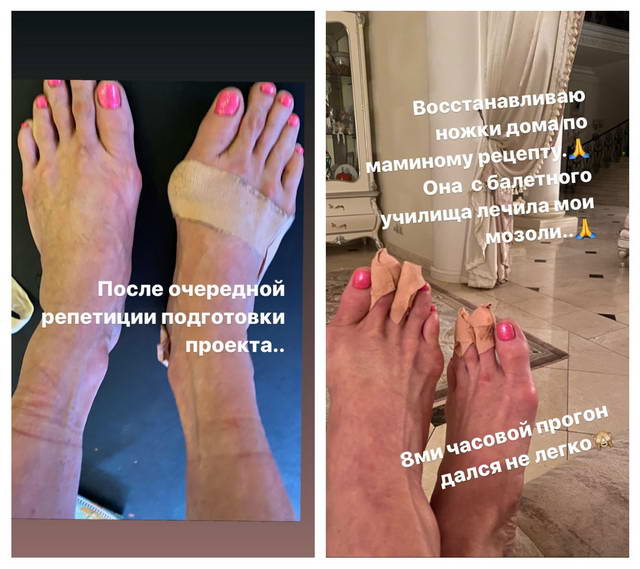 Анастасия Волочкова показала натруженные ноги